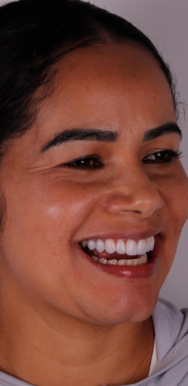 Paciente sorrindo depois do tratamento